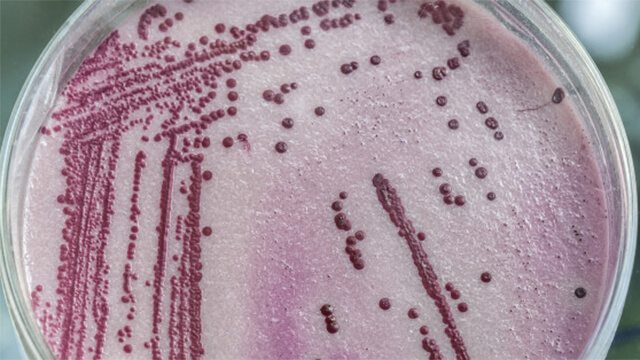 Close Up of a Tuberculosis Bacteria